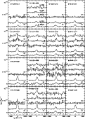 \begin{figure}
{
\psfig{figure=ms10191f3.eps,width=14cm} }
\end{figure}