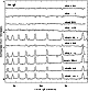 \begin{figure}
\par\includegraphics[width=7cm,clip]{h1978f2.ps}
\end{figure}