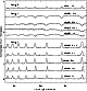 \begin{figure}
\par\includegraphics[width=7cm,clip]{h1978f3.ps}
\end{figure}