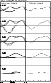 \begin{figure}
\par\includegraphics[width=8.8cm,clip]{h2666f4.ps}\end{figure}