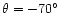 $\theta = -70^{\circ}$