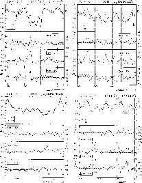 \begin{figure}
\par\hbox{\psfig{figure=H2663a12.ps,width=88mm}\hspace{3mm} \psfi...
...dth=88mm} \hspace{3mm}
\psfig{figure=H2663d12.ps,width=88mm} }
\par\end{figure}
