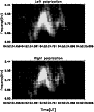 \begin{figure}
\par\includegraphics[width=8.2cm,clip]{wm_m.ps}
\end{figure}