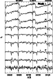 \begin{figure}
\par {\resizebox{8.8cm}{!}{\rotatebox{0}{\includegraphics{h3885f3.eps}}} }\end{figure}