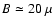 $B \simeq 20~\mu$