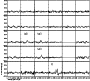 \begin{figure}
\par\includegraphics[width=7.8cm,clip]{6302fig1.eps}
\end{figure}