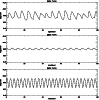\begin{figure}
\par\resizebox{8.8cm}{!}{\includegraphics{8496fig9.ps}}
\end{figure}