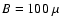$B = 100~\mu$