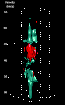 \begin{figure}
\par\includegraphics[width=5.6cm,clip]{1292fi13.eps}
\end{figure}
