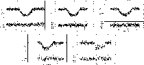 \begin{figure}
\par\includegraphics[width=5.9cm,clip]{00001fig1.eps}\hspace*{3mm...
...
\includegraphics[width=5.9cm,clip]{00005fig5.eps}\hspace*{2.8cm}}\end{figure}
