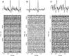 Thumbnail: Fig. 1. Refer to the following caption and surrounding text.
