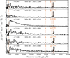 Thumbnail: Fig. 2. Refer to the following caption and surrounding text.