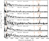 Thumbnail: Fig. A.2. Refer to the following caption and surrounding text.