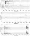 Thumbnail: Fig. B.1 Refer to the following caption and surrounding text.