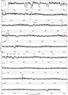 Thumbnail: Fig. B.1. Refer to the following caption and surrounding text.