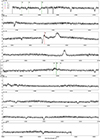Thumbnail: Fig. B.2. Refer to the following caption and surrounding text.