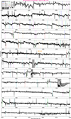 Thumbnail: Fig. B.3. Refer to the following caption and surrounding text.