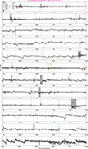Thumbnail: Fig. B.4. Refer to the following caption and surrounding text.