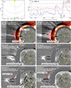 Thumbnail: Fig. 2. Refer to the following caption and surrounding text.